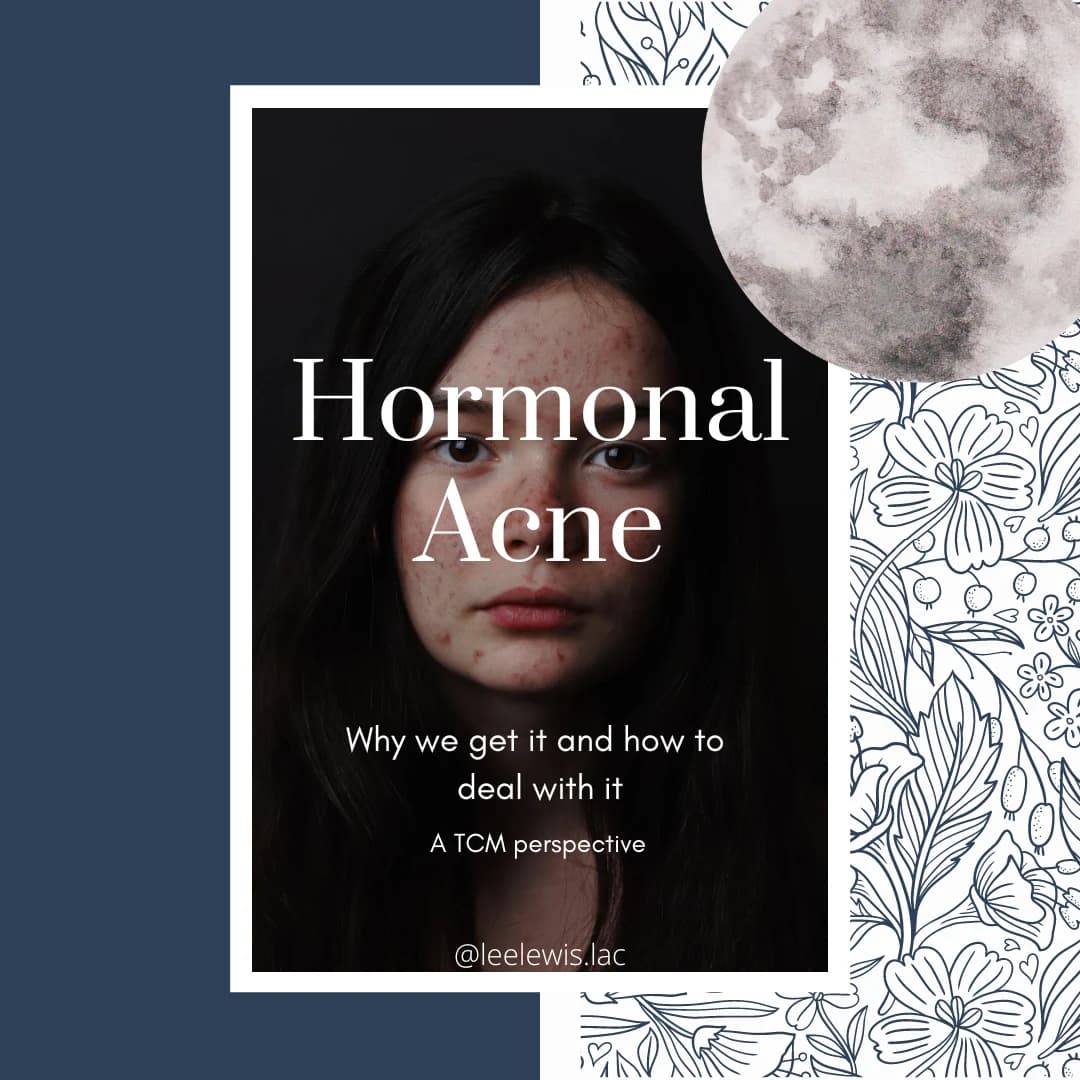 Hormonal Acne: Preparing for a Skin Consultation