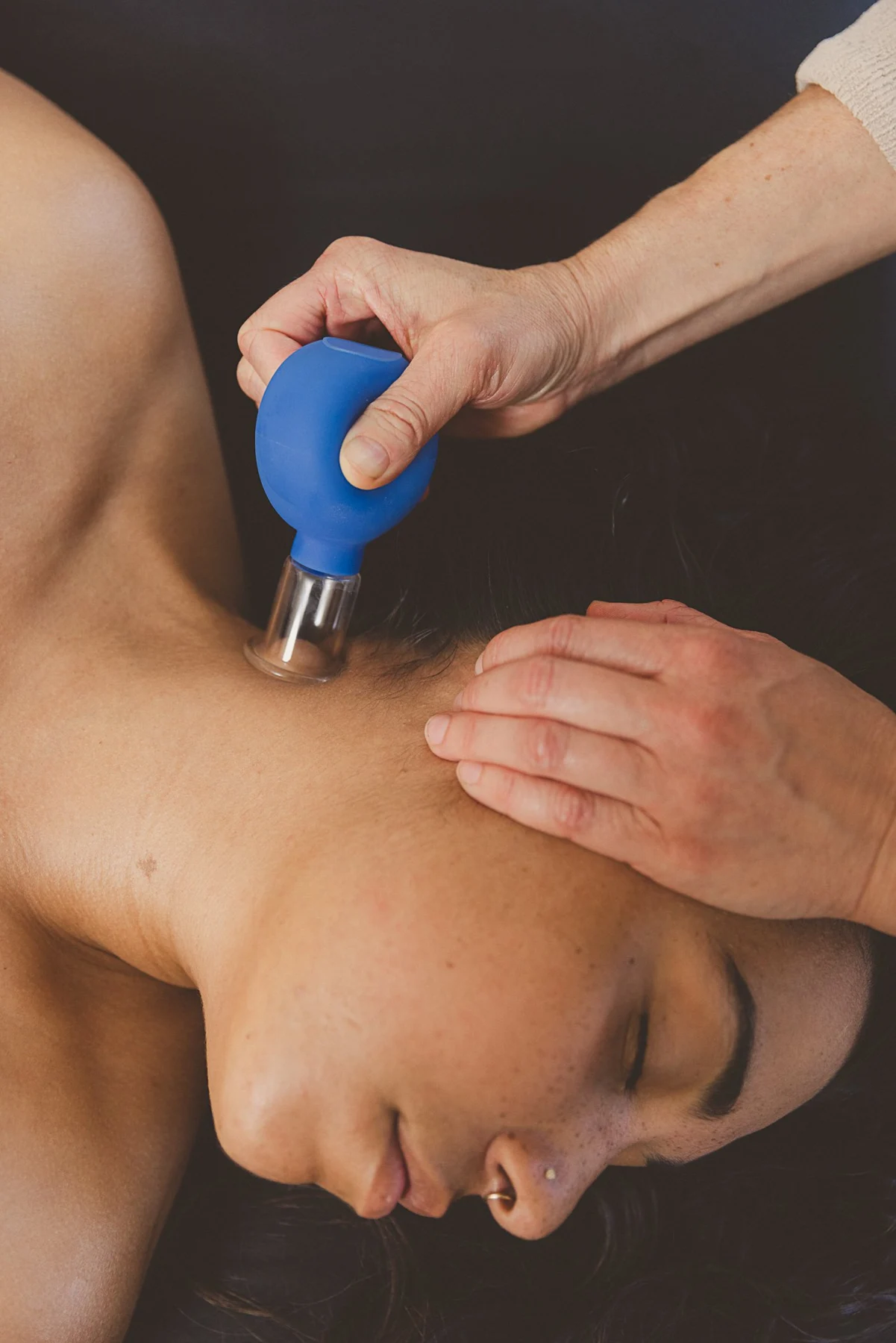 Cupping equipment and technique